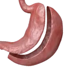 ניתוח שרוול 