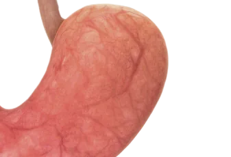 ניתוח קיצור קיבה