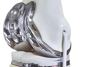 החלפת מפרק ברך