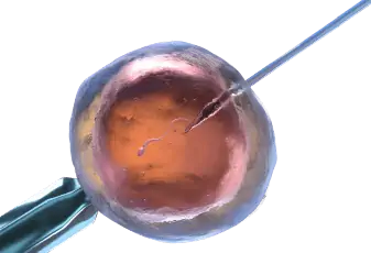 תרומת ביצית 